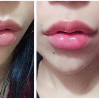Kem Làm Hồng Môi XLIP 5ml Gcell Hàn quốc