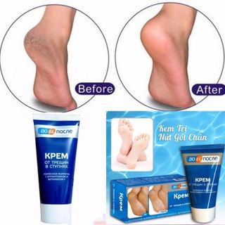 Kem trị nứt gót chân Kpem Apteka của Nga 50ML giá sỉ