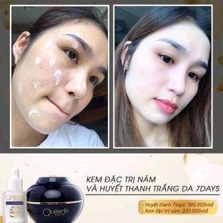 kem trị nám Queenie