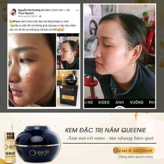 kem trị nám Queenie