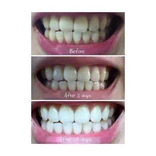 Bột thảo dược trắng răng T-White