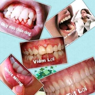 Bột thảo dược trắng răng T-White