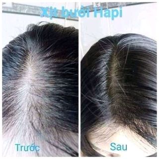 serum xịt bưởi trị rụng kích mọc tóc trị gàu