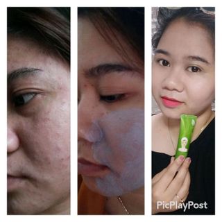 Thải độc da Olic - Detox Mask