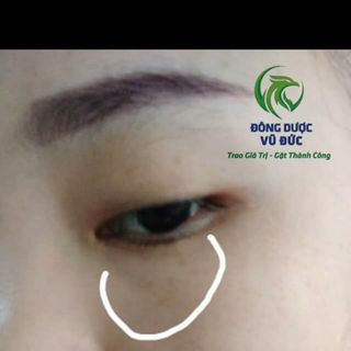 GIÁ SỈ HUYẾT HỒNG SÂM TRỊ MỤN