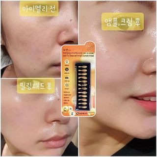 Viên collagen tươi ammud Hàn Quốc