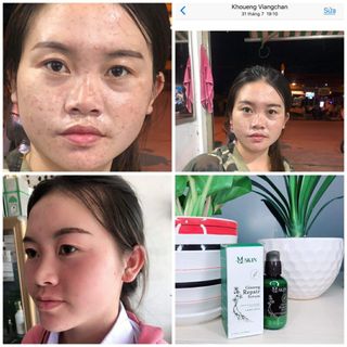 Serum thay da nhân sâm MQSKIN