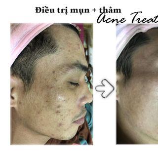 Mặt nạ tươi phục hồi Ecotrue - Red Clay Soft Mask 100ml
