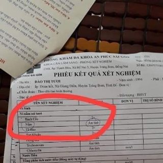 Viên Đặt Phụ Khoa Nữ Oa