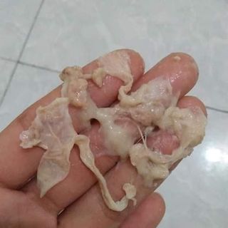 Phụ khoa Hoàng Hải Yến