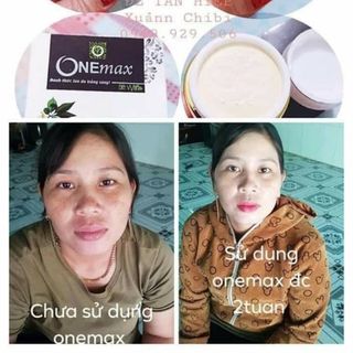 Kem feac trị nám sạn thâm ONEMAX