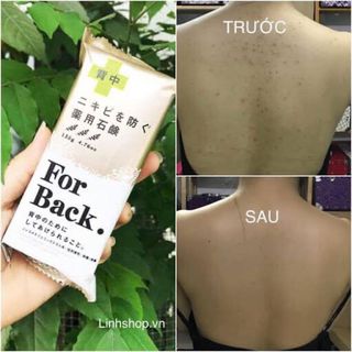 Xà Phòng Trị Mụn Lưng For Back ForBack