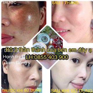 KEM ĐÔNG Y GIA TRUYỀN PHẠM NGUYÊN