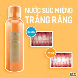 Nước súc miệng diệt khuẩn Propolinse 600ml
