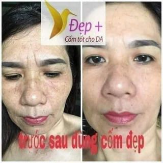 CỐM ĐẸP DA - CÂN BẰNG NỘI TIẾT TỐ