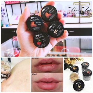 Tẩy tế bào chết môi
