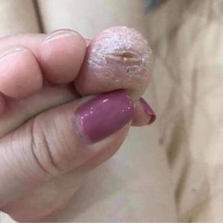 KEM BÔI CHỐNG NỨT NẺ