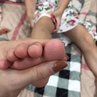 KEM BÔI CHỐNG NỨT NẺ