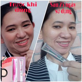 KEM TRỊ THÂM QUẦNG MẮT BỌNG MẮT- KÈM ĐẦU MASSAGE TỰ ĐỘNG- HANCO EYE CREAM