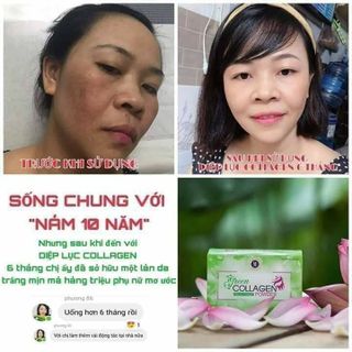 Diệp lục collagen