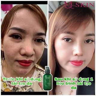 THAY DA NHÂN SÂM MQ SKIN HÀN QUỐC
