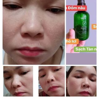 THAY DA NHÂN SÂM MQ SKIN HÀN QUỐC