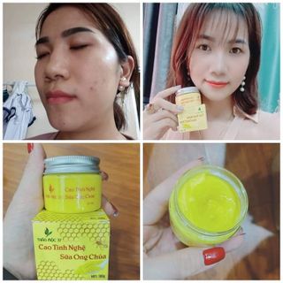 TUYỂN SĨ CAO TINH NGHỆ SỮA NON PHÁP