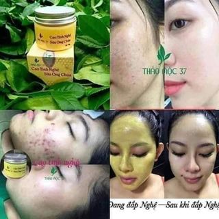 TUYỂN SĨ CAO TINH NGHỆ SỮA NON PHÁP