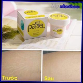KEM TRỊ RẠN DA PASJEL VÀNG