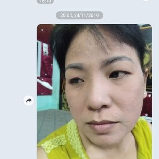 Serum tái tạo da trị mụn thâm trắng da trị rỗ se khít lỗ chân lông