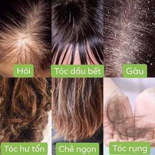 Dầu Gội Vi Jully Cosmetic
