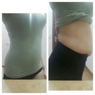 Áo Gen Định Hình Xuất Nhật Akira - Nịt Bụng Nâng Ngực - Cao Cấp Thoáng Mát - 100 Ren Cotton