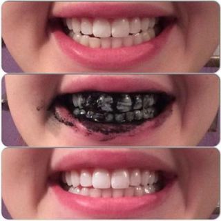 Trắng Răng Mộc Xuân Tán