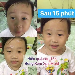 Kem Muỗi baby love skin