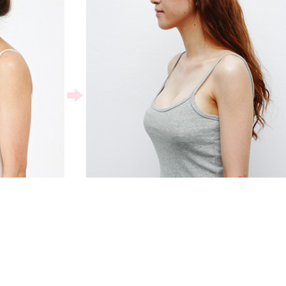Nở Ngực Vòng Một Upsize hàng Nga 100