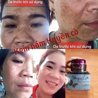 kem nám Huyền Cò