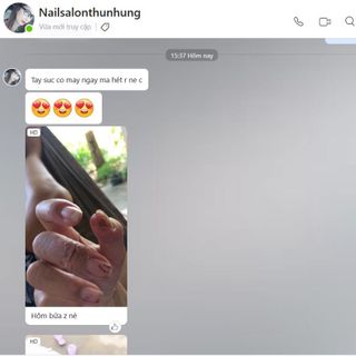 Thuốc đông y chữa nứt nẻ tay chân