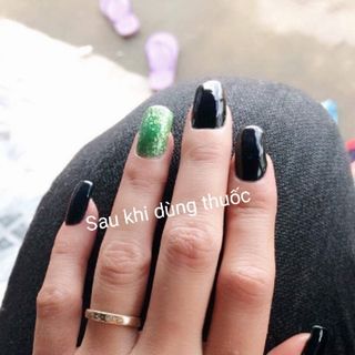 Thuốc đông y chữa nứt nẻ tay chân