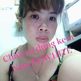 Kem trị nám tàn nhang CC White