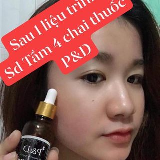 Thuốc trị mụn PD
