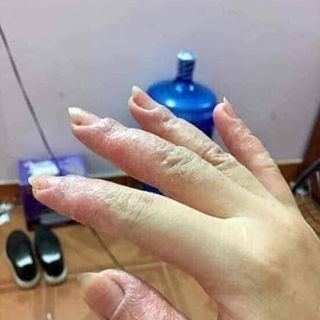 Thảo mộc bôi da Trần Kim Huyền