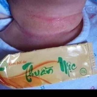 Bôi da đặt trị da liễu thuần mộc
