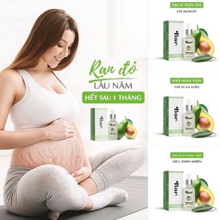 TINH CHẤT TRỊ RẠN DA BAE
