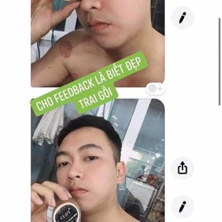 Trị mụn dưỡng da phục hồi da hư tổn