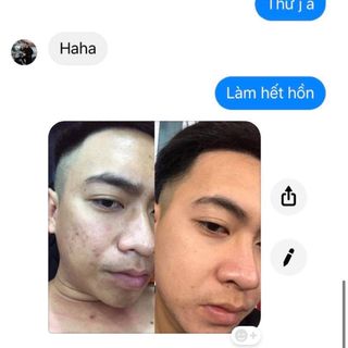 Trị mụn dưỡng da phục hồi da hư tổn