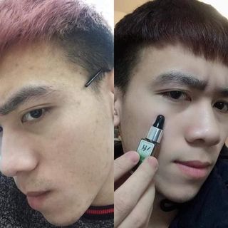 Trị mụn Dr.MAI Mix Saffron