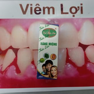 Tinh dầu chữa sâu răng- hôi miệng - viêm họng- viêm amidam
