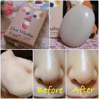 Xà Phòng Trị Mụn Đầu Đen Mũi Dot Washy Facial Social 7.5g