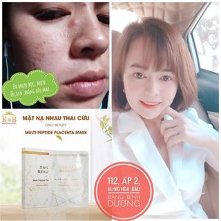 MẶT NẠ TẾ BÀO GỐC NHAU THAI CỪU KOREA