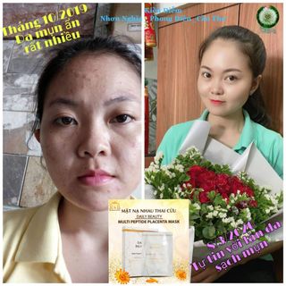 MẶT NẠ TẾ BÀO GỐC NHAU THAI CỪU KOREA
